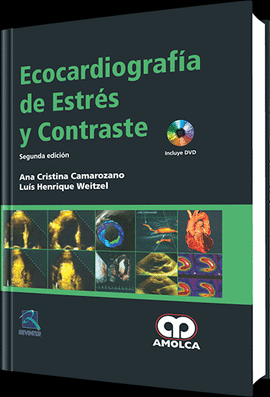 ECOCARDIOGRAF�A DE ESTR�S Y CONTRASTE