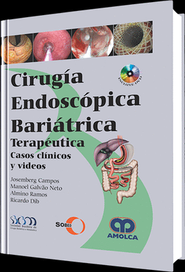 CIRUGIA ENDOSCOPICA BARIATRICA TERAPEUTICA CASOS CLINICIOS Y VIDEOS