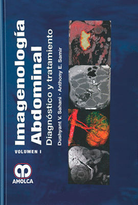 IMAGENOLOGIA ABDOMINAL