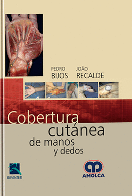 COBERTURA CUTANEA DE MANOS Y DEDOS