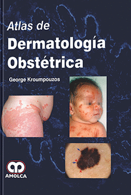 ATLAS DE DERMATOLOG�A OBST�TRICA