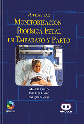 ATLAS DE MONITORIZACION BIOFISICA FETAL EN EMBARAZO Y PARTO