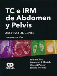 TC E IRM DE ABDOMEN Y PELVIS
