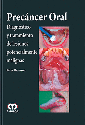 PREC�NCER ORAL