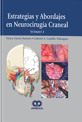ESTRATEGIAS Y ABORDAJES EN NEUROCIRUGIA CRANEAL  2 TOMOS