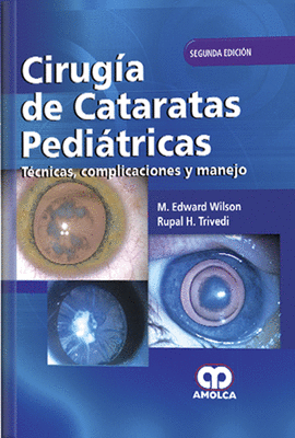 CIRUGIA DE CATARATAS PEDIATRICAS COMPLICACIONES Y MANEJO