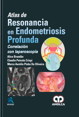 ATLAS DE RESONANCIA EN ENDOMETRIOSIS PROFUNDA