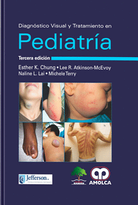 DIAGNOSTICO VISUAL Y TRATAMIENTO EN PEDIATRIA�