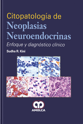 CITOPATOLOG�A DE NEOPLASIAS NEUROENDOCRINAS