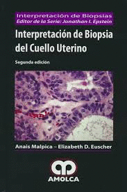 INTERPRETACIN DE BIOPSIA DEL CUELLO UTERINO