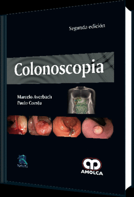 COLONOSCOPIA