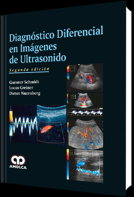 DIAGNOSTICO DIFERENCIAL EN IMAGENES DE ULTRASONIDO