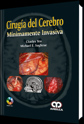 CIRUGIA DEL CEREBRO MINIMAMENTE INVASIVA