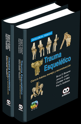 TRAUMA ESQUEL�TICO 2 TMS