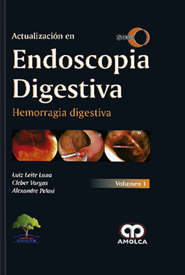 ACTUALIZACION ENDOSCOPIA DIGESTIVA HEMORRAGIA DIGESTI