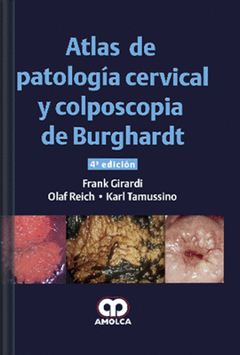 ATLAS DE PATOLOG�A CERVICAL Y COLPOSCOPIA DE BURGHARDT