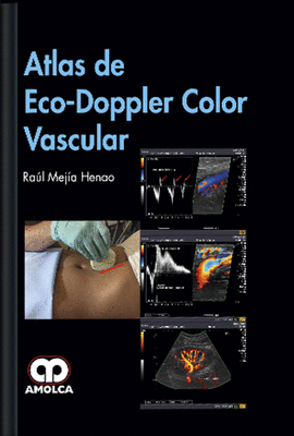 ATLAS  DE ECO-DOPPLER COLOR VASCULAR