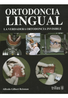 ORTODONCIA LINGUAL LA VERDADERA ORTODONCIA INVISIBLE