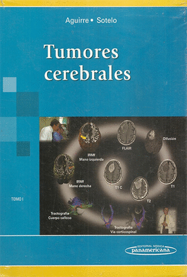 TUMORES CEREBRALES I