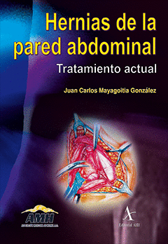 HERNIAS DE LA PARED ABDOMINAL TRATAMIENTO ACTUAL