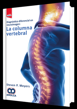 DIAGN�STICO DIFERENCIAL EN NEUROIMAGEN: LA COLUMNA VERTEBRAL