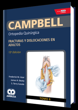 CAMPBELL TOMO 6 ORTOPEDIA QUIRRGICA FRACTURAS Y DISLOCACIONES EN ADULTOS