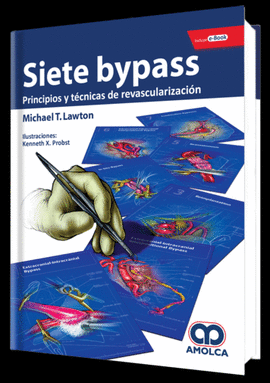 SIETE BYPASS. PRINCIPIOS Y T�CNICAS DE REVASCULARIZACI�N + E-BOOK