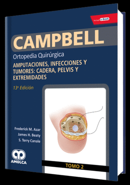 CAMPBELL TOMO 2 ORTOPEDIA QUIRRGICA AMPUTACIONES, INFECCIONES Y TUMORES: CADERA, PELVIS Y EXTREMIDADES