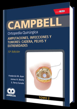CAMPBELL TOMO 2 ORTOPEDIA QUIR�RGICA AMPUTACIONES, INFECCIONES Y TUMORES: CADERA, PELVIS Y EXTREMIDADES