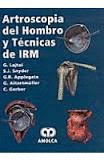 ARTROSCOPIA DEL HOMBRO Y TECNICAS DE IRM