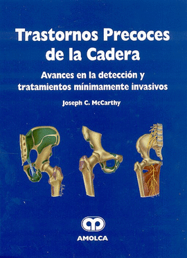 TRASTORNOS PRECOCES DE LA CADERA AVANCES EN LA DETECCION Y TRATAMIENTOS MINIMAMENTE INVASIVOS