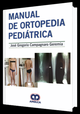 MANUAL DE ORTOPEDIA PEDIATRICA