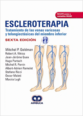 ESCLEROTERAPIA TRATAMIENTO DE LAS VENAS VARICOSAS Y TELANGIECTASICAS DEL MIEMBRO INFERIOR
