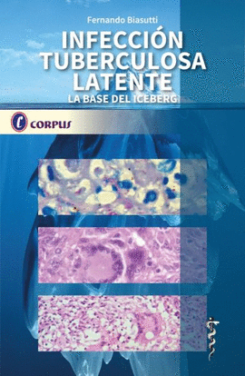 INFECCI�N TUBERCULOSA LATENTE