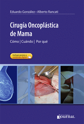 CIRUGIA ONCOPLASTICA DE MAMA