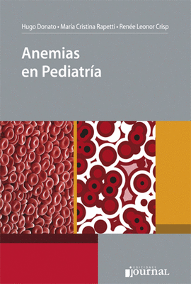 ANEMIAS EN PEDIATRIA