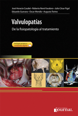 VALVULOPATIAS