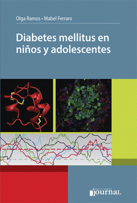 DIABETES MELLITUS EN NI�OS Y ADOLESCENTES