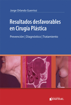 RESULTADOS DESFAVORABLES EN CIRUGIA PLASTICA