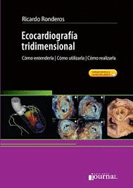 ECOCARDIOGRAF�A TRIDIMENSIONAL