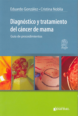 DIAGNOSTICO Y TRATAMIENTO DEL CANCER DE MAMA GUIA DE PROCEDIMIENTOS