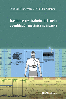 TRASTORNOS RESPIRATORIOS DEL SUEO Y VENTILACIN MECNICA NO INVASIVA