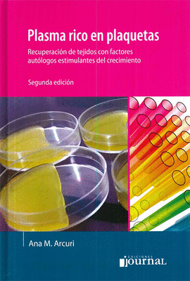 PLASMA RICO EN PLAQUETAS