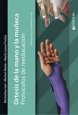 ORTESIS DE LA MANO Y LA MU�ECA PROTOCOLOS DE REEDUCACION