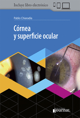 CRNEA Y SUPERFICIE OCULAR