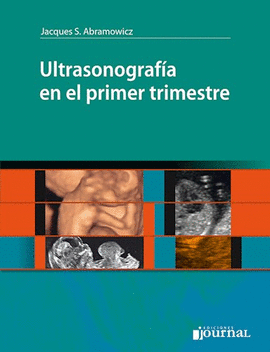 ULTRASONOGRAFIA EN EL PRIMER TRIMESTRE