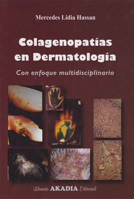 COLAGENOPAT�AS EN DERMATOLOG�A