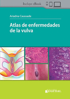 ATLAS DE ENFERMEDADES DE LA VULVA