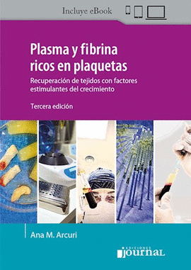 PLASMA Y FIBRINA RICOS EN PLAQUETAS