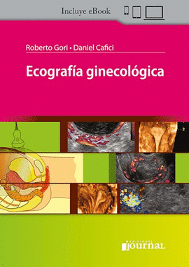 ECOGRAF�A GINECOL�GICA